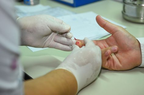 Nuevos centros de testeo rápido y gratuito de HIV/Sida en Matheu y Maquinista Savio