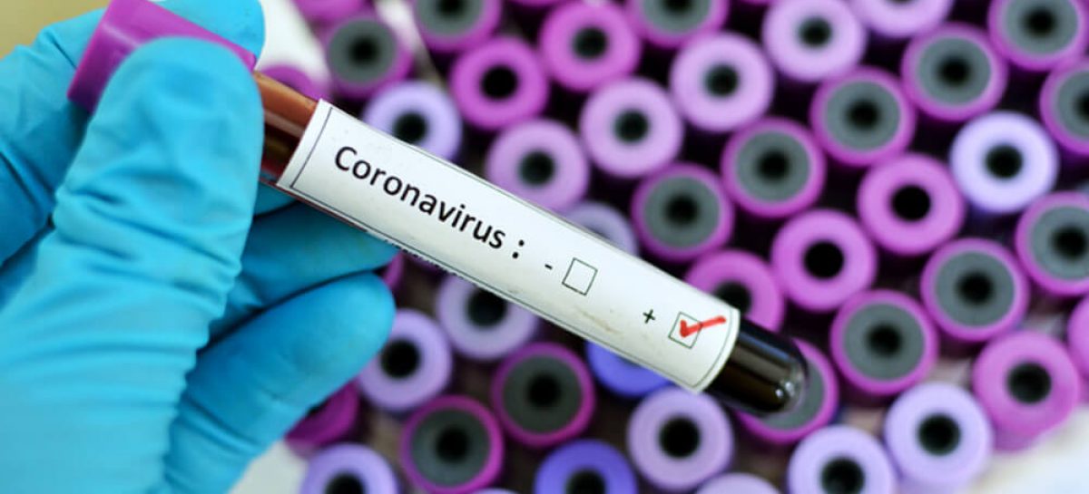 Coronavirus: sobre el final del mes de julio Escobar distrito totaliza 42 fallecidos y más de 1500 contagios positivos